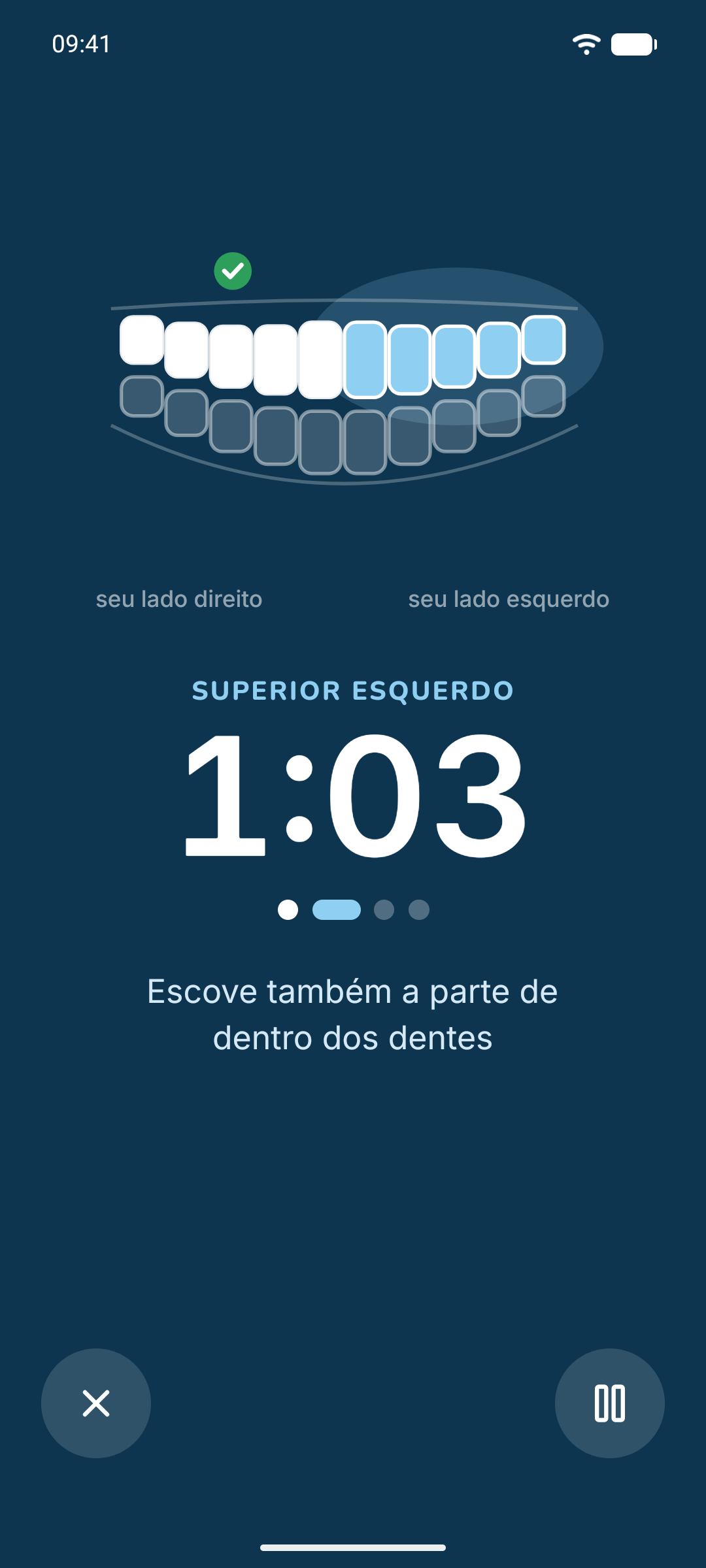 Timer de escovação: os dentes do lado superior esquerdo destacados e 1:03 no relógio.